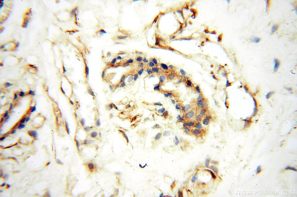 Immunohistochemistry (IHC) staining of human skin tissue using Alpha Tubulin Polyclonal antibody (10759-1-AP)