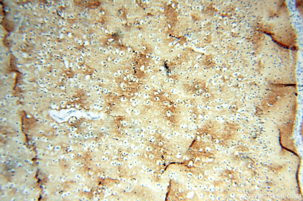 Immunohistochemistry (IHC) staining of human brain tissue using Alpha Tubulin Polyclonal antibody (10759-1-AP)