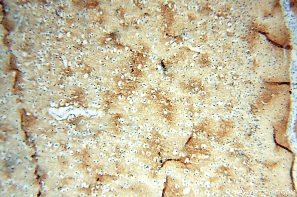 Immunohistochemistry (IHC) staining of human brain tissue using Alpha Tubulin Polyclonal antibody (10759-1-AP)