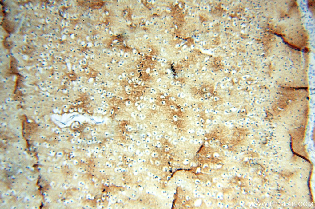 IHC staining of human brain using 10759-1-AP