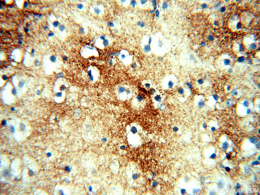 Immunohistochemistry (IHC) staining of human brain tissue using Alpha Tubulin Polyclonal antibody (10759-1-AP)
