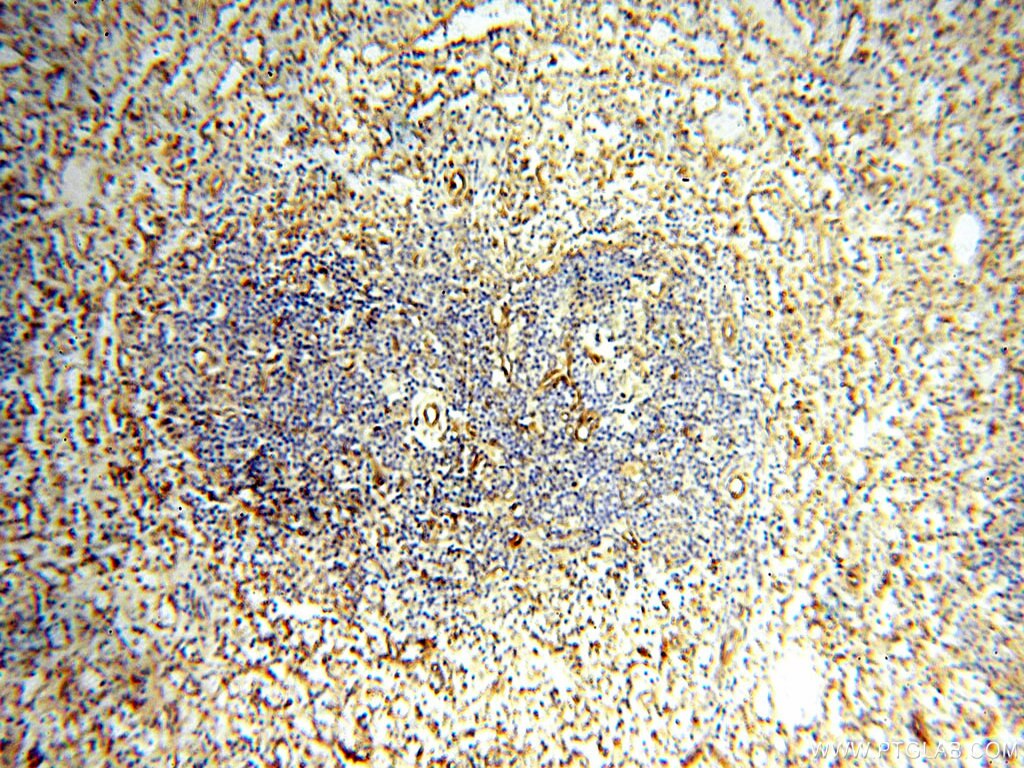 Immunohistochemistry (IHC) staining of human spleen tissue using Alpha Tubulin Polyclonal antibody (10759-1-AP)