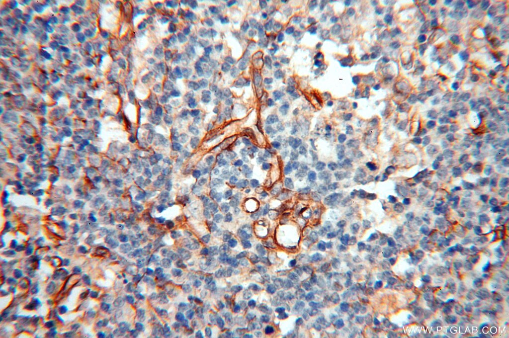 Immunohistochemistry (IHC) staining of human spleen tissue using Alpha Tubulin Polyclonal antibody (10759-1-AP)