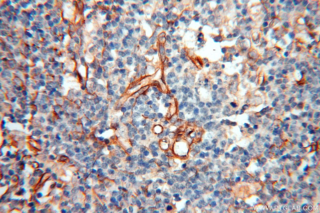 IHC staining of human spleen using 10759-1-AP