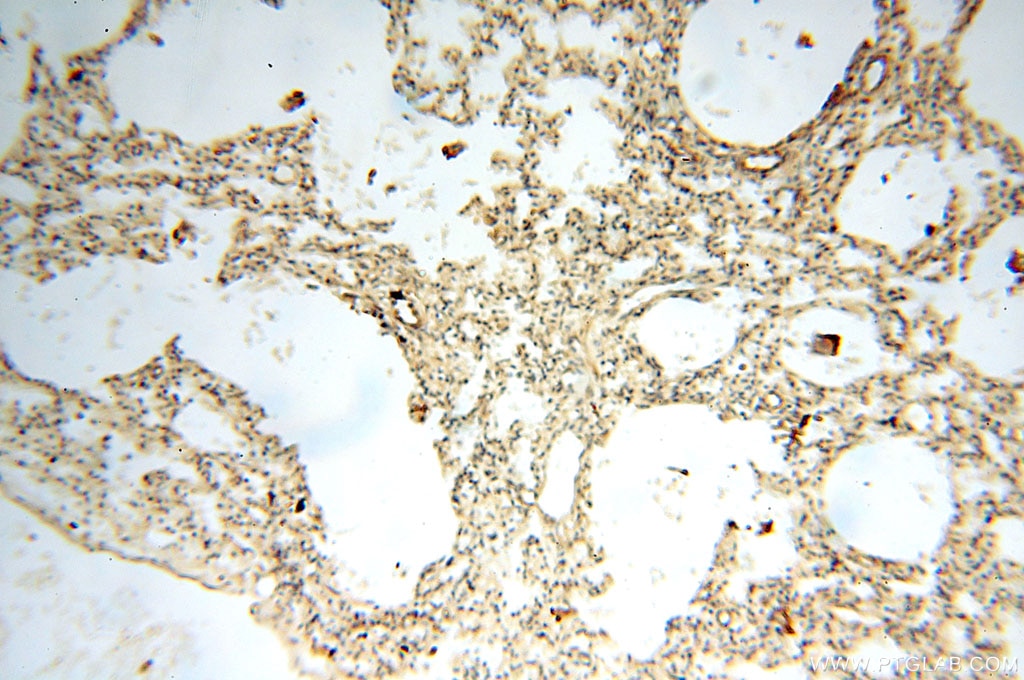 Immunohistochemistry (IHC) staining of human lung tissue using Alpha Tubulin Polyclonal antibody (10759-1-AP)