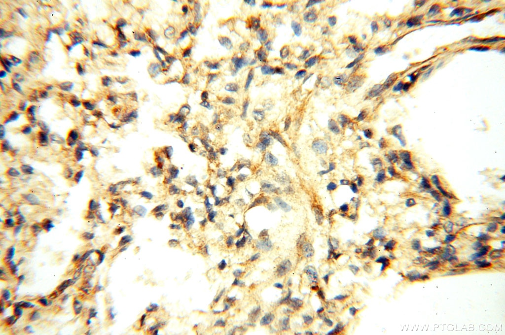 Immunohistochemistry (IHC) staining of human lung tissue using Alpha Tubulin Polyclonal antibody (10759-1-AP)