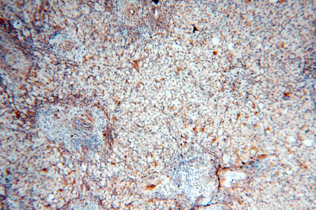 Immunohistochemistry (IHC) staining of human ovary tissue using Alpha Tubulin Polyclonal antibody (10759-1-AP)