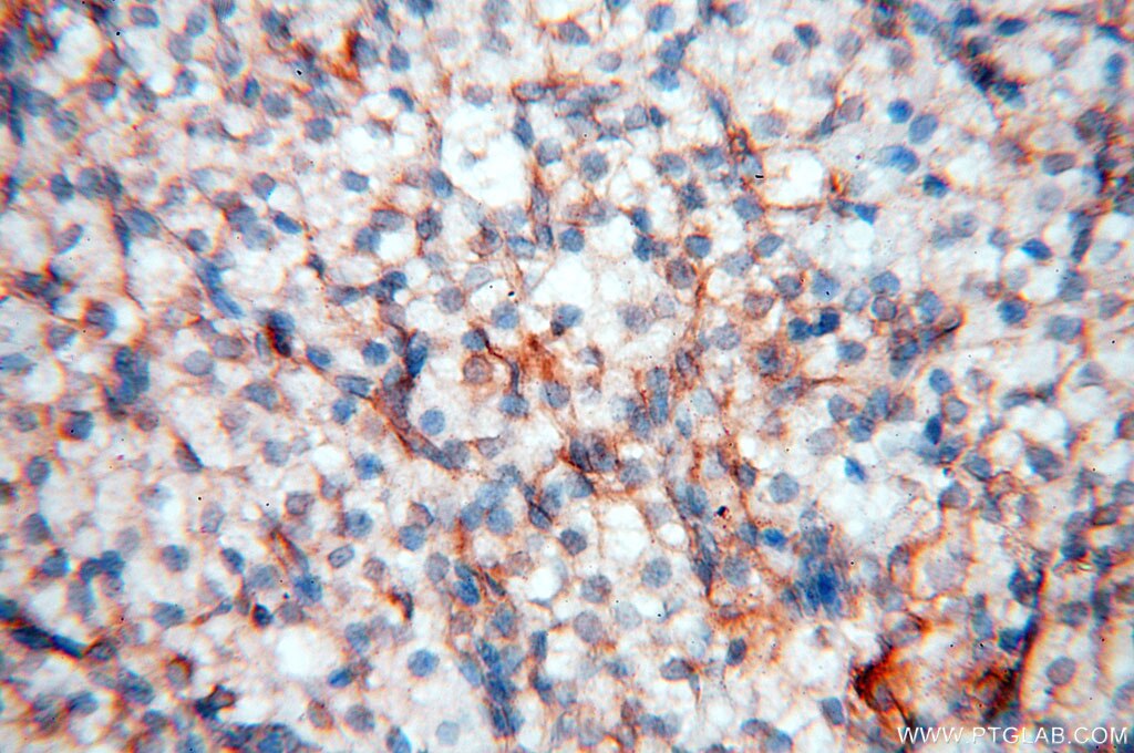Immunohistochemistry (IHC) staining of human ovary tissue using Alpha Tubulin Polyclonal antibody (10759-1-AP)