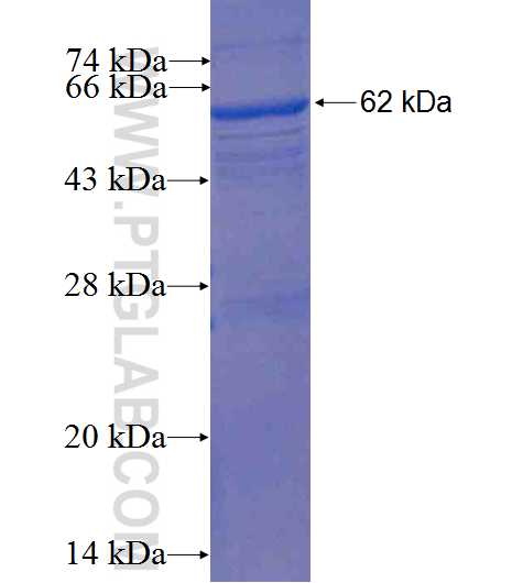tubulin-alpha fusion protein Ag1181 SDS-PAGE