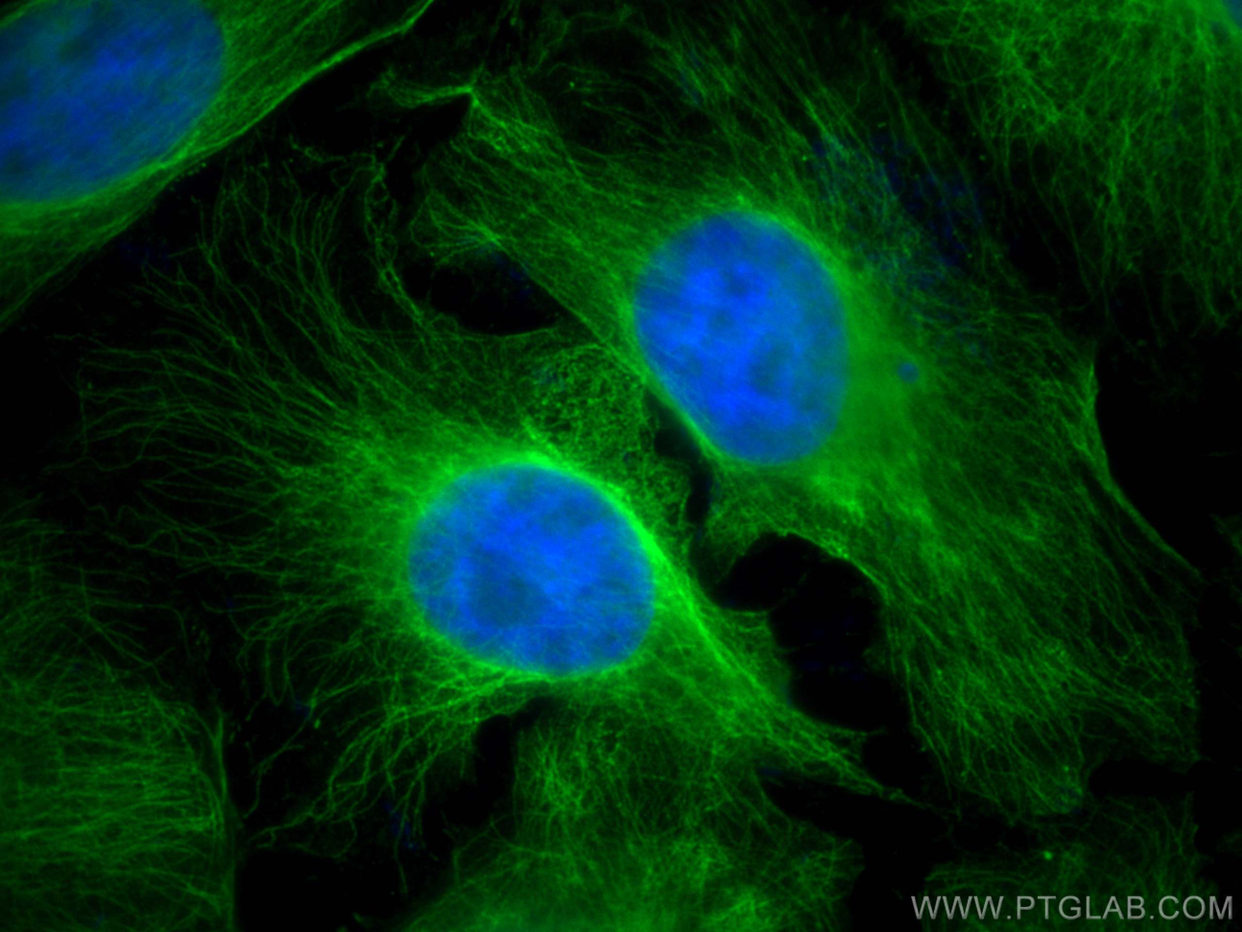 Immunofluorescence (IF) / fluorescent staining of HeLa cells using Alpha Tubulin Polyclonal antibody (14555-1-AP)