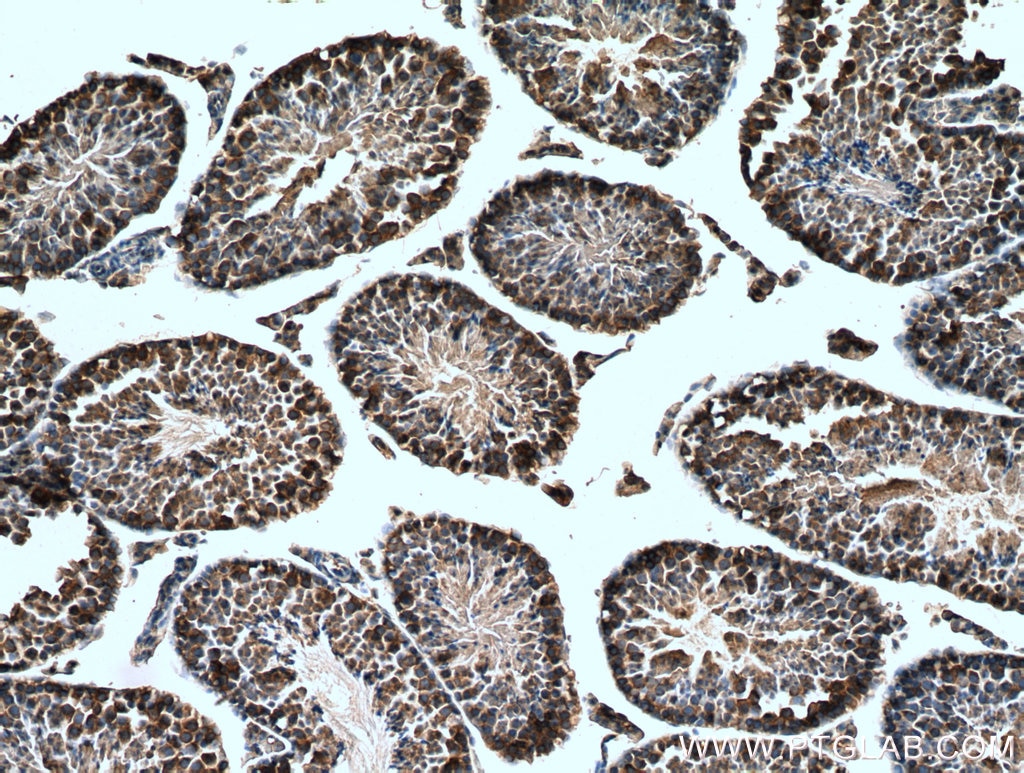 Immunohistochemistry (IHC) staining of mouse testis tissue using Alpha Tubulin Polyclonal antibody (14555-1-AP)