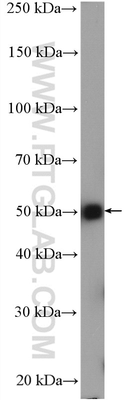 WB analysis of mouse brain using 14555-1-AP