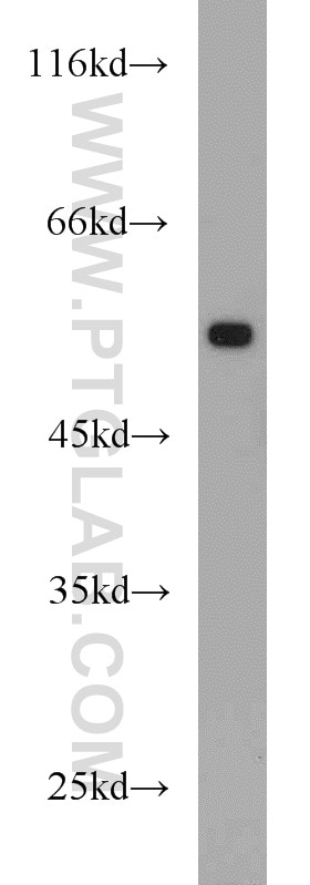 Western Blot (WB) analysis of HeLa cells using Alpha Tubulin Polyclonal antibody (14555-1-AP)