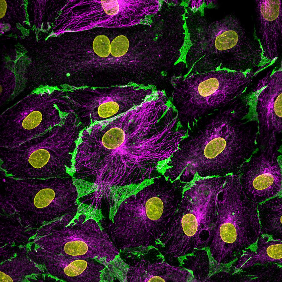 Immunofluorescence (IF) / fluorescent staining of Lymphatic endothelial cells cells using Alpha Tubulin Polyclonal antibody (11224-1-AP)