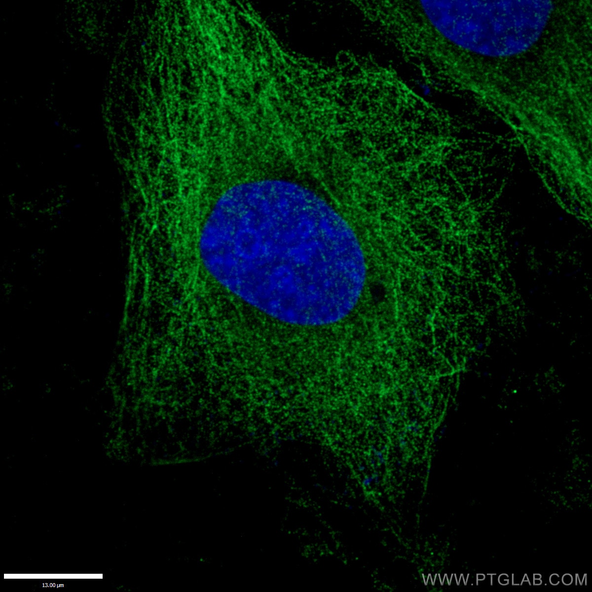 IF Staining of HepG2 using 11224-1-AP