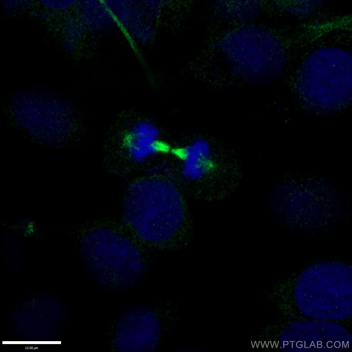 IF Staining of HepG2 using 11224-1-AP