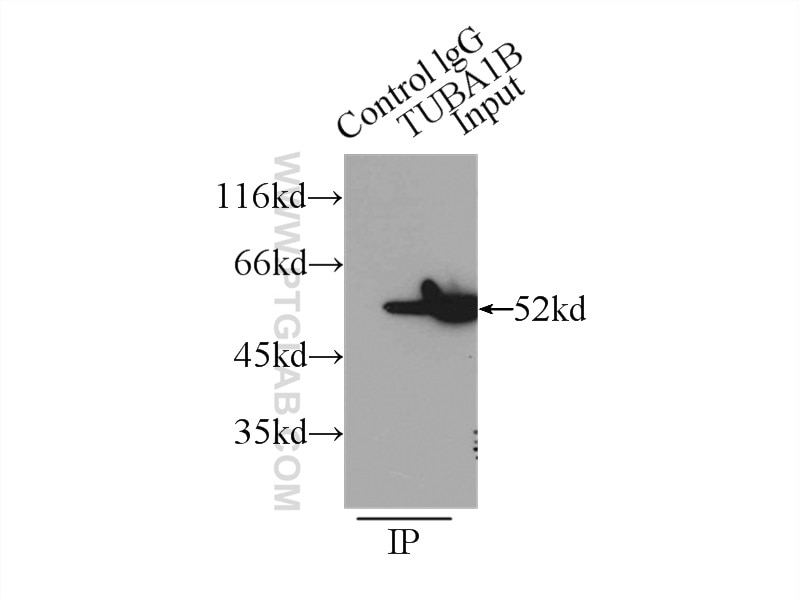 Immunoprecipitation (IP) experiment of HeLa cells using Alpha Tubulin Polyclonal antibody (11224-1-AP)