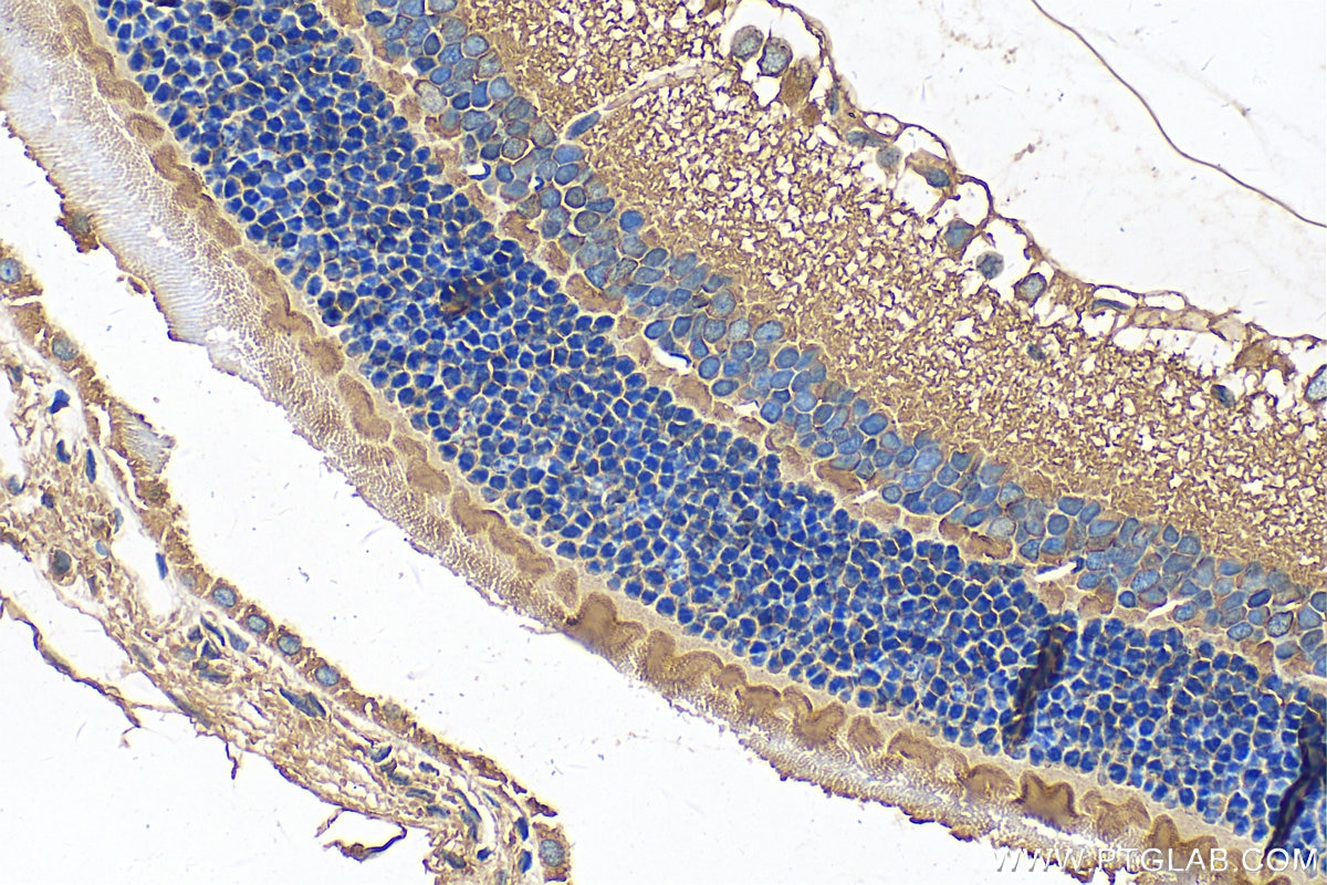 Immunohistochemistry (IHC) staining of rat eye tissue using Alpha Tubulin Polyclonal antibody (16007-1-AP)