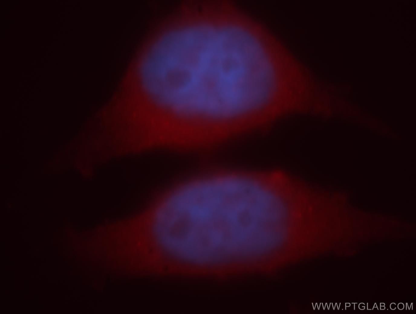 Immunofluorescence (IF) / fluorescent staining of HeLa cells using Alpha Tubulin Polyclonal antibody (18062-1-AP)