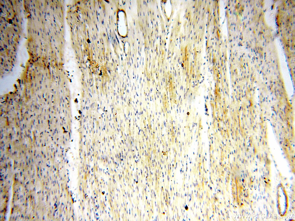 Immunohistochemistry (IHC) staining of human heart tissue using Alpha Tubulin Polyclonal antibody (18062-1-AP)