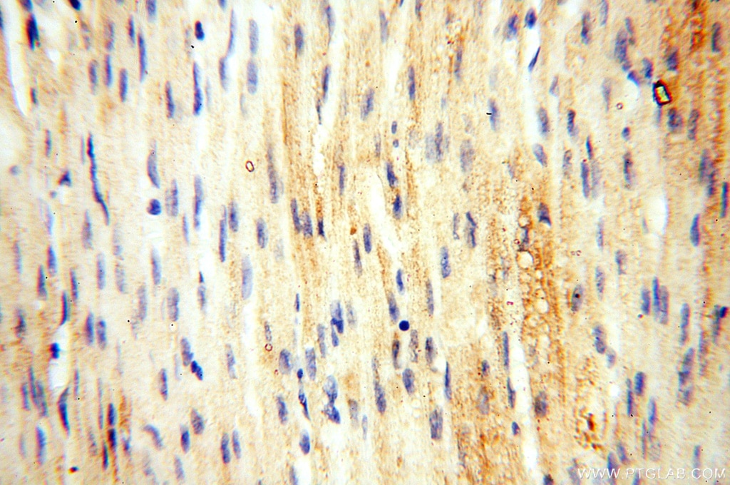 Immunohistochemistry (IHC) staining of human heart tissue using Alpha Tubulin Polyclonal antibody (18062-1-AP)