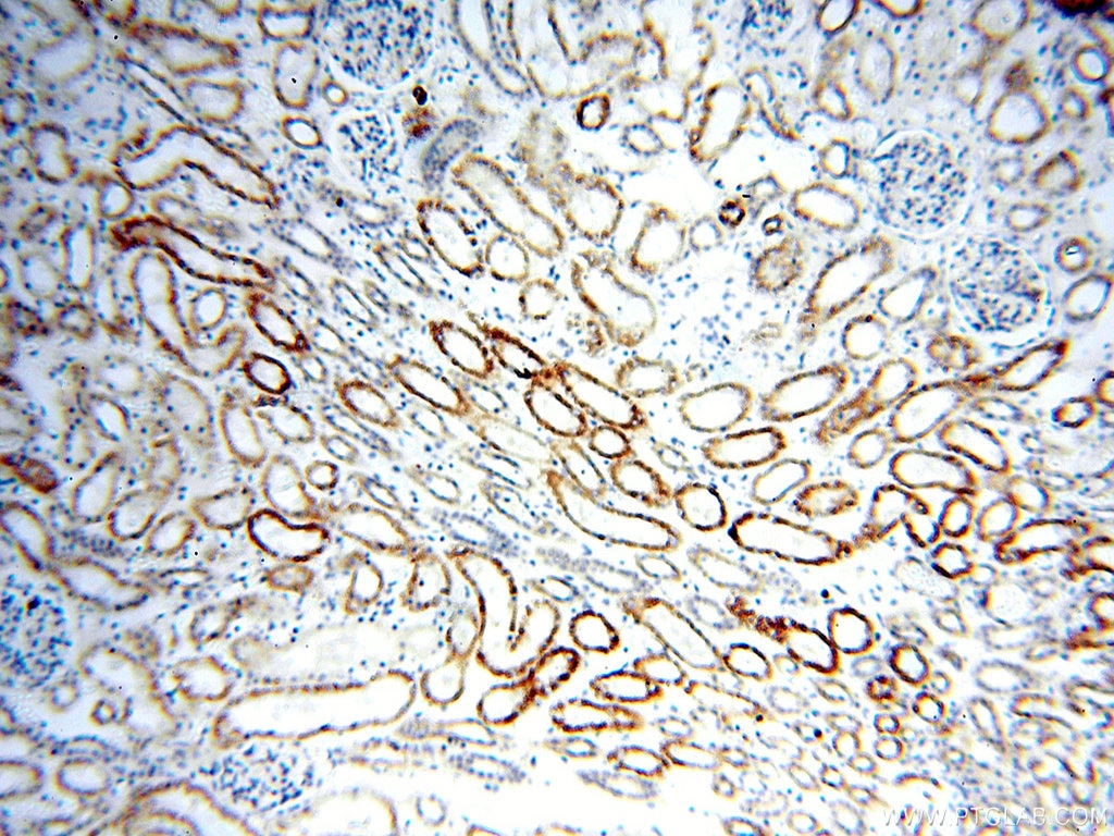Immunohistochemistry (IHC) staining of human kidney tissue using Alpha Tubulin Polyclonal antibody (18062-1-AP)