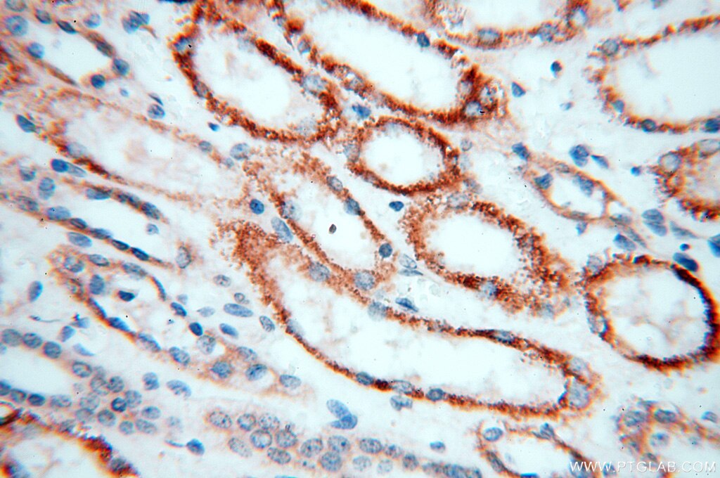 Immunohistochemistry (IHC) staining of human kidney tissue using Alpha Tubulin Polyclonal antibody (18062-1-AP)
