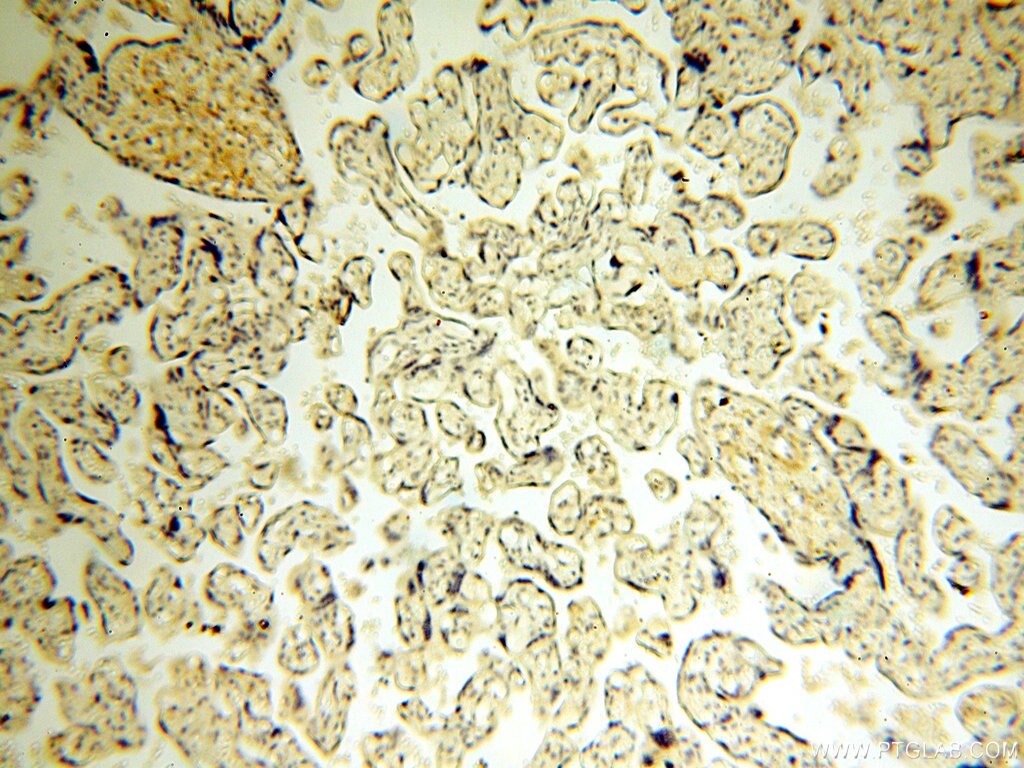 Immunohistochemistry (IHC) staining of human placenta tissue using Alpha Tubulin Polyclonal antibody (18062-1-AP)