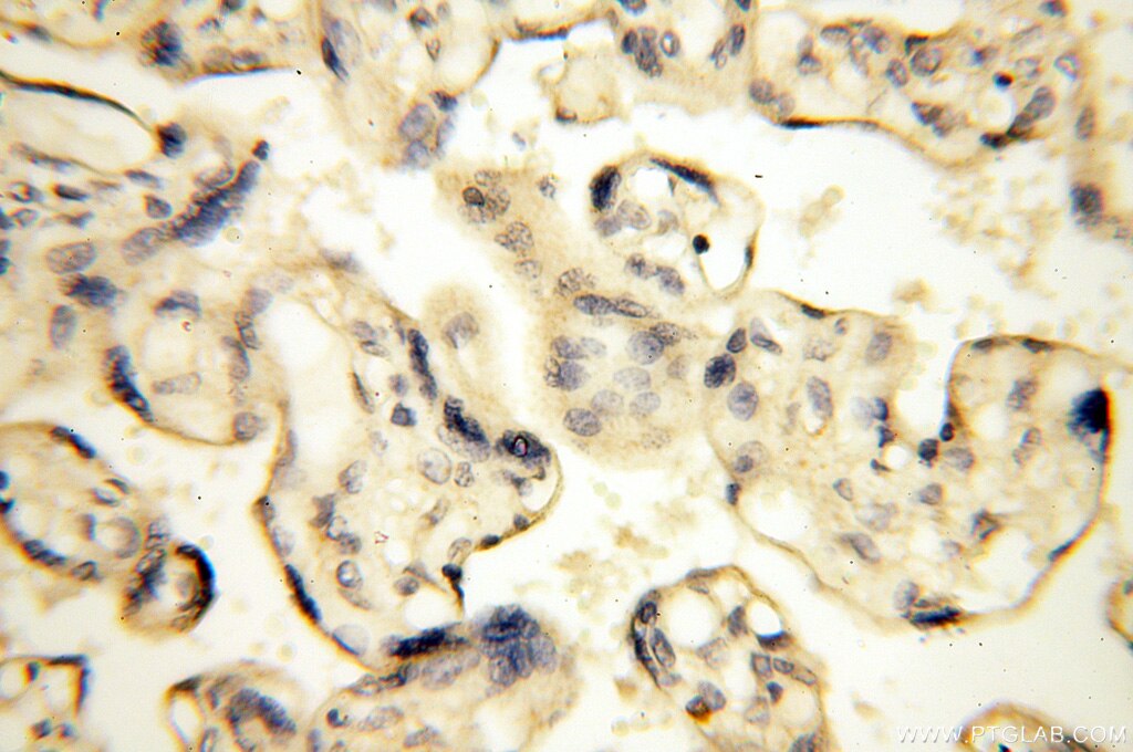 Immunohistochemistry (IHC) staining of human placenta tissue using Alpha Tubulin Polyclonal antibody (18062-1-AP)