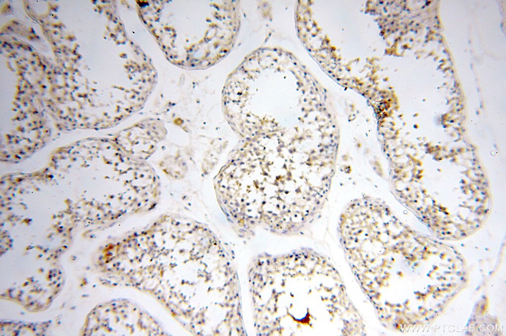 Immunohistochemistry (IHC) staining of human testis tissue using Alpha Tubulin Polyclonal antibody (18062-1-AP)