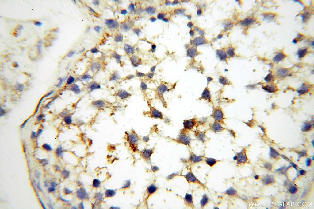 Immunohistochemistry (IHC) staining of human testis tissue using Alpha Tubulin Polyclonal antibody (18062-1-AP)