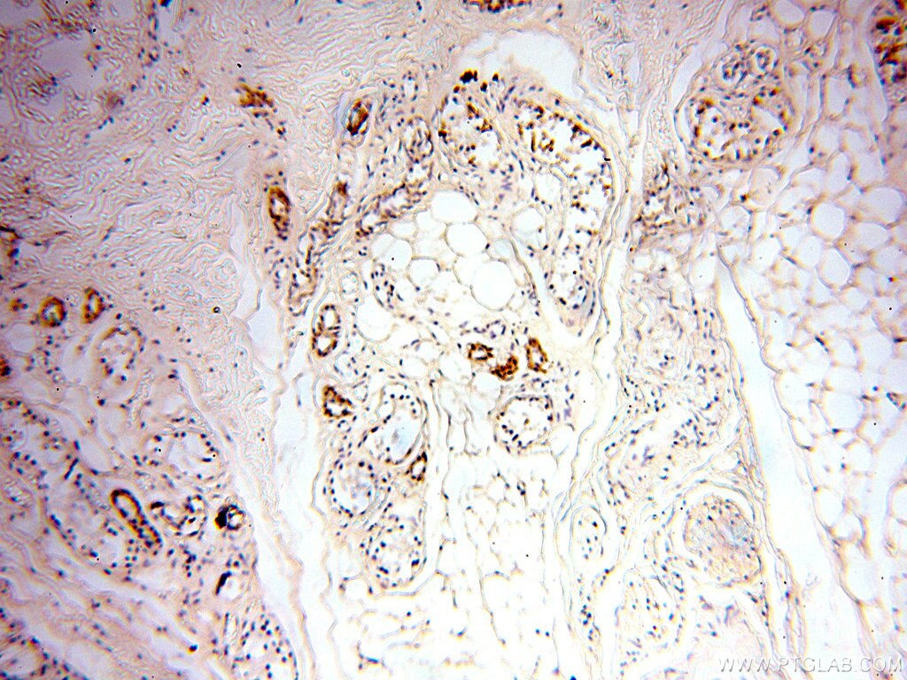 Immunohistochemistry (IHC) staining of human skin tissue using Alpha Tubulin Polyclonal antibody (18062-1-AP)