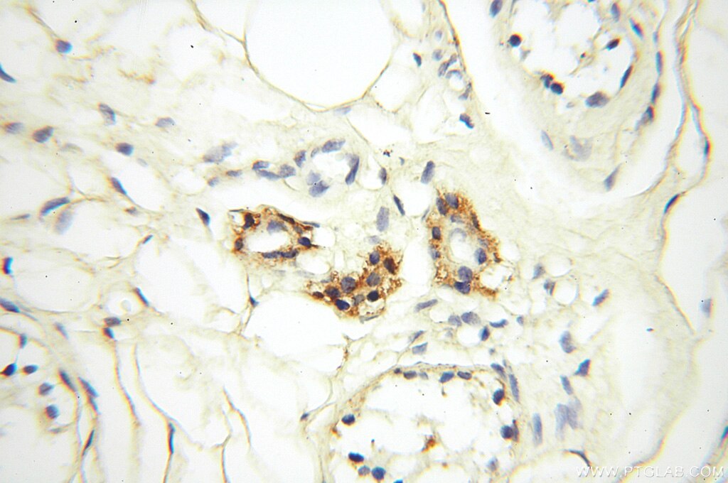 Immunohistochemistry (IHC) staining of human skin tissue using Alpha Tubulin Polyclonal antibody (18062-1-AP)
