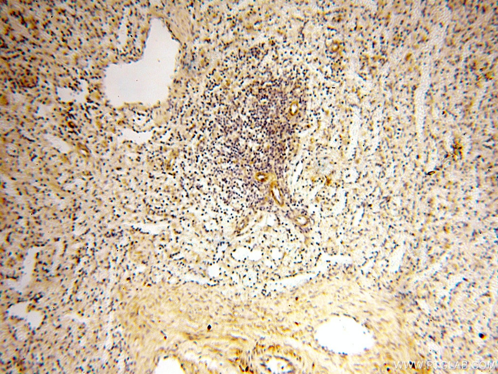 Immunohistochemistry (IHC) staining of human spleen tissue using Alpha Tubulin Polyclonal antibody (18062-1-AP)