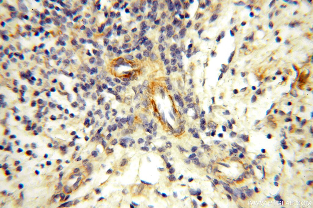 Immunohistochemistry (IHC) staining of human spleen tissue using Alpha Tubulin Polyclonal antibody (18062-1-AP)