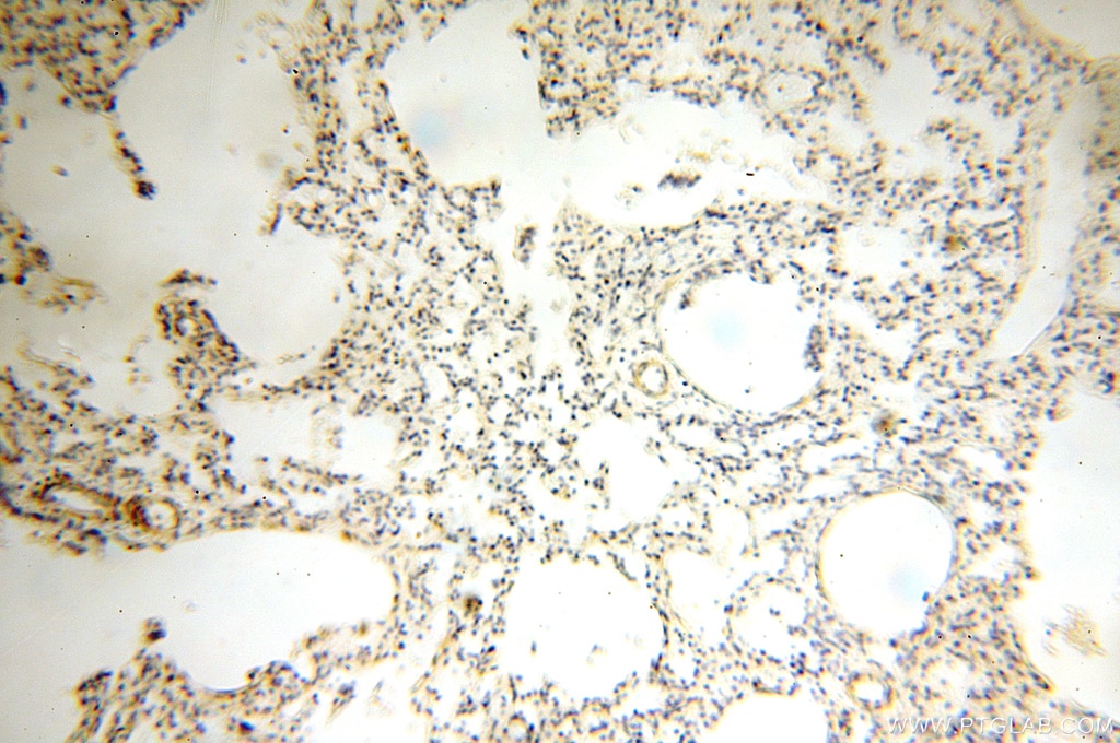Immunohistochemistry (IHC) staining of human lung tissue using Alpha Tubulin Polyclonal antibody (18062-1-AP)