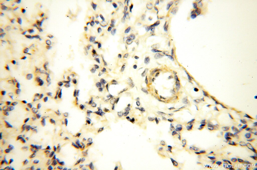 Immunohistochemistry (IHC) staining of human lung tissue using Alpha Tubulin Polyclonal antibody (18062-1-AP)