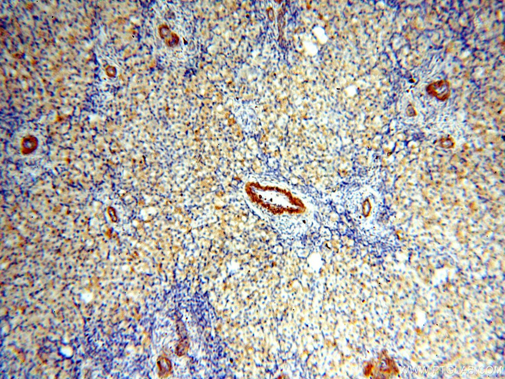 Immunohistochemistry (IHC) staining of human ovary tissue using Alpha Tubulin Polyclonal antibody (18062-1-AP)