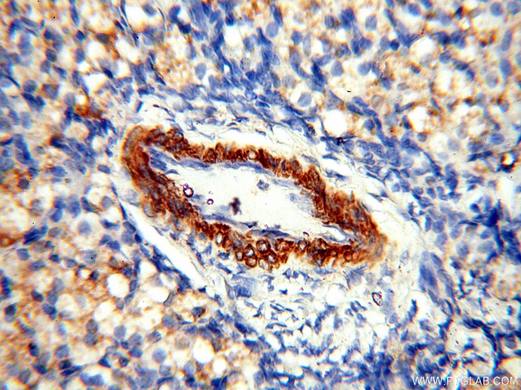 Immunohistochemistry (IHC) staining of human ovary tissue using Alpha Tubulin Polyclonal antibody (18062-1-AP)