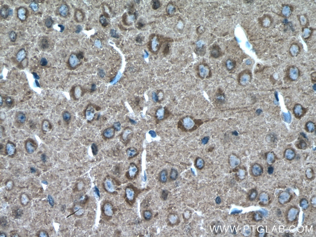 Immunohistochemistry (IHC) staining of mouse brain tissue using Beta Tubulin Polyclonal antibody (10094-1-AP)