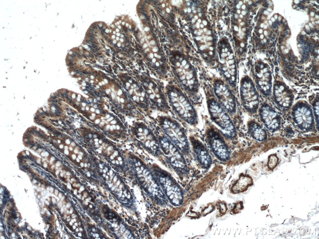 IHC staining of human colon using 10094-1-AP