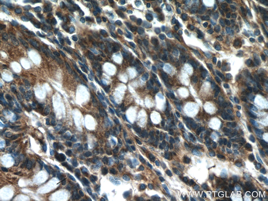 Immunohistochemistry (IHC) staining of human colon tissue using Beta Tubulin Polyclonal antibody (10094-1-AP)