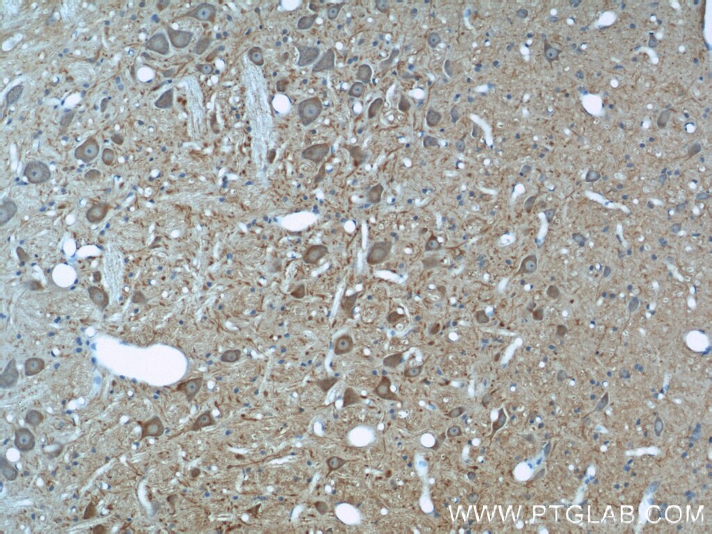 Immunohistochemistry (IHC) staining of rat brain tissue using Beta Tubulin Polyclonal antibody (10094-1-AP)