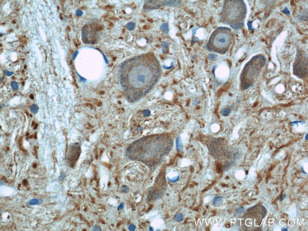 Immunohistochemistry (IHC) staining of rat brain tissue using Beta Tubulin Polyclonal antibody (10094-1-AP)