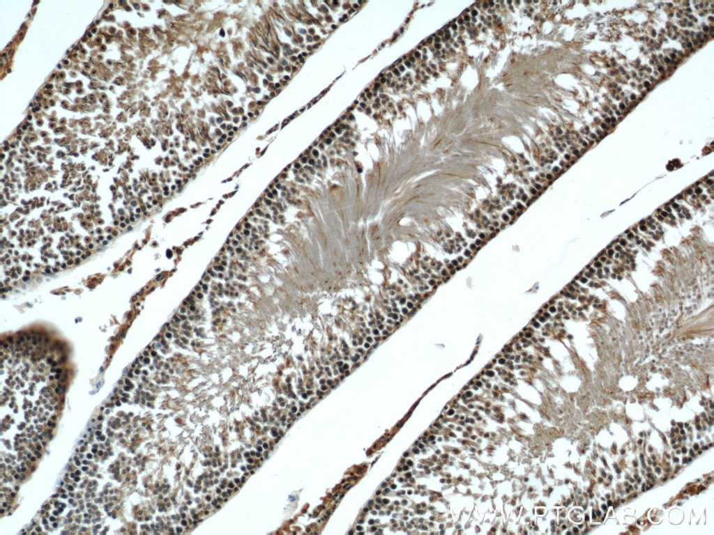 IHC staining of rat testis using 10094-1-AP