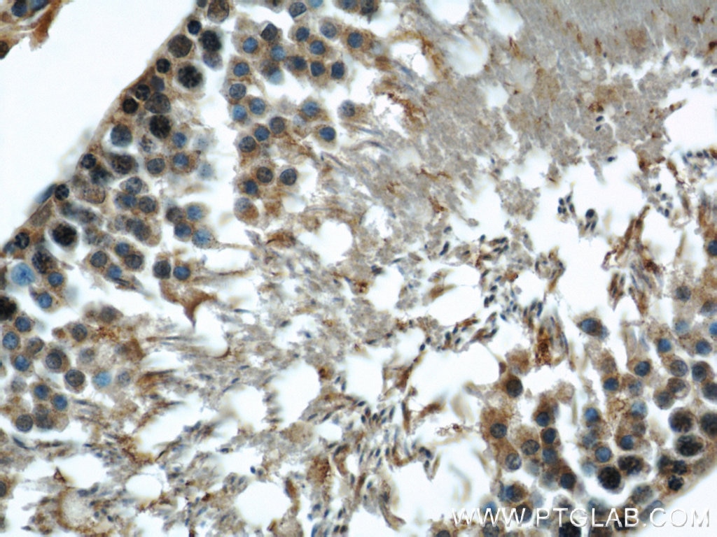 Immunohistochemistry (IHC) staining of rat testis tissue using Beta Tubulin Polyclonal antibody (10094-1-AP)