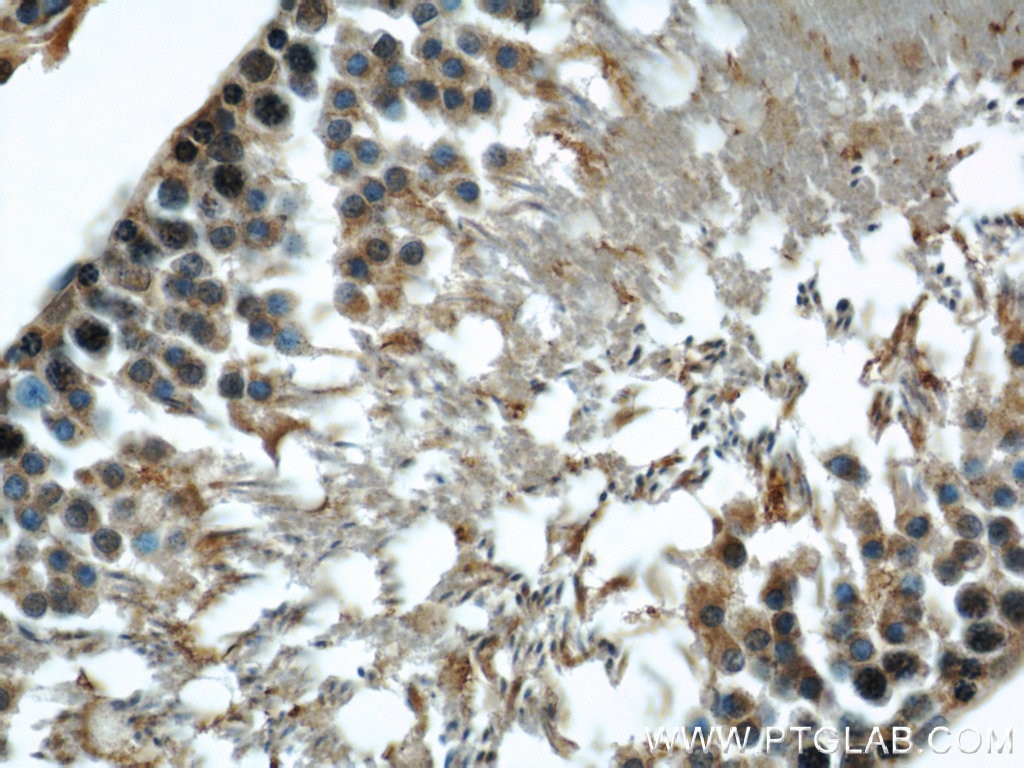 IHC staining of rat testis using 10094-1-AP