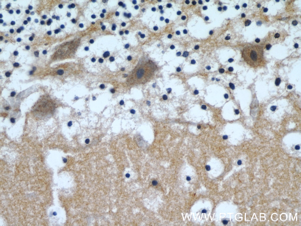 Immunohistochemistry (IHC) staining of human cerebellum tissue using Beta Tubulin Polyclonal antibody (10094-1-AP)