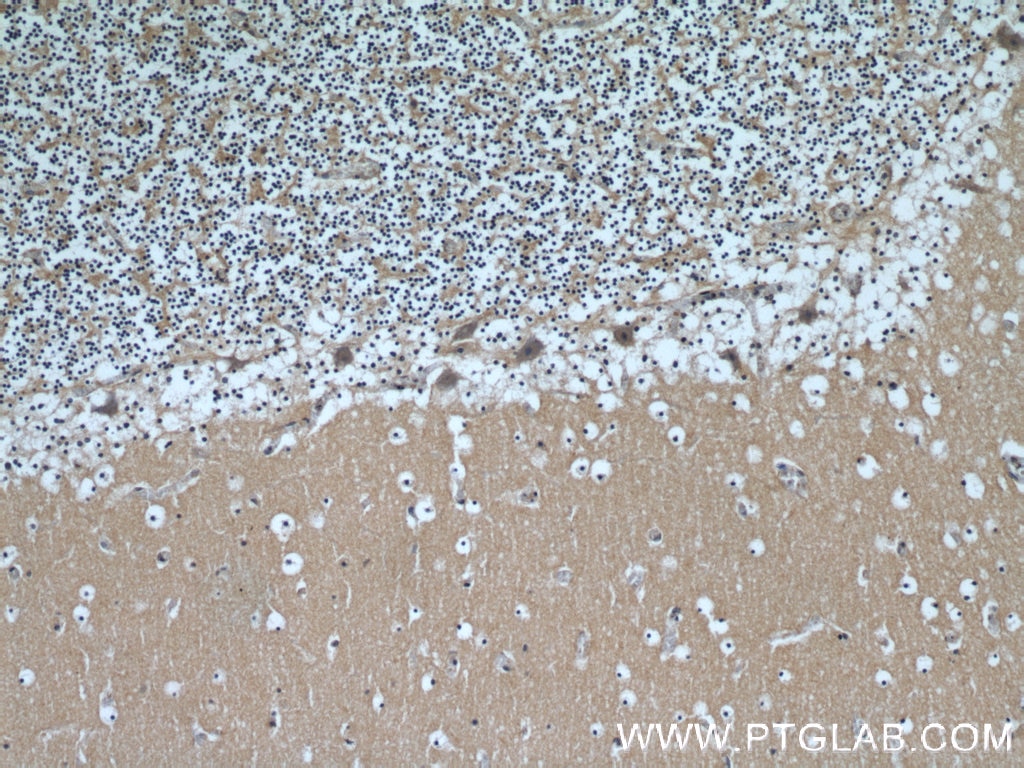 IHC staining of human cerebellum using 10094-1-AP