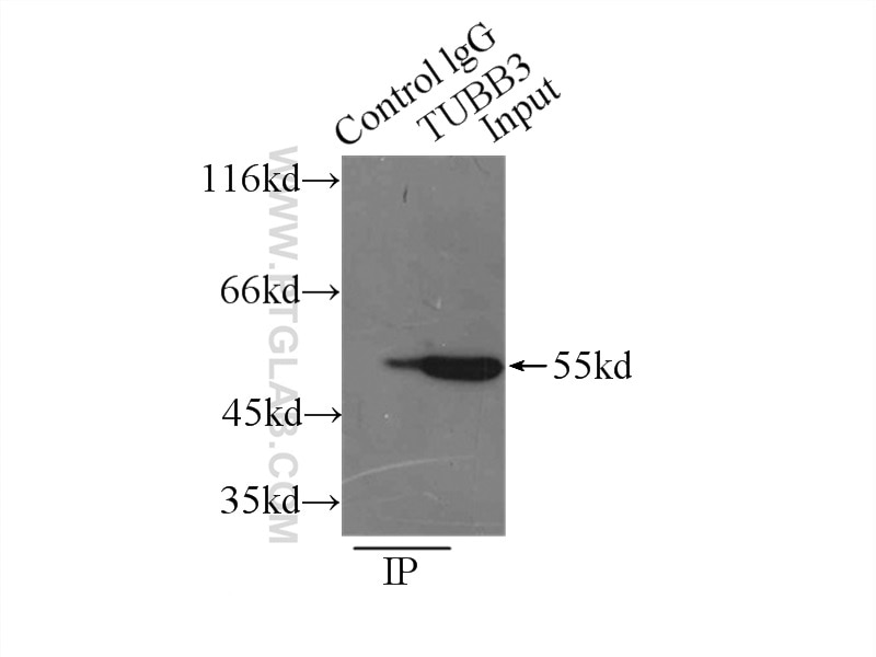 Immunoprecipitation (IP) experiment of mouse brain tissue using Beta Tubulin Polyclonal antibody (10094-1-AP)